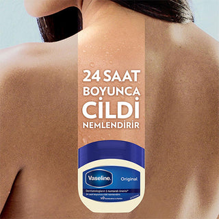 vaseline original moisturizing jelly 100 ml, vaseline moisturizing jelly application on hands, vaseline jelly for dry skin hydration Vaseline Original Moisturizing Jelly - 24 Hour Hydration for Dry Skin | 100 ml Vaseline Original Moisturizing Jelly 100 ml - Hydrates & Protects vaseline, moisturizing-jelly, hydration, dry-skin, skin-care, daily-usage, hypoallergenic, dermatologist-approved, 24-hour-hydration, ai-generated