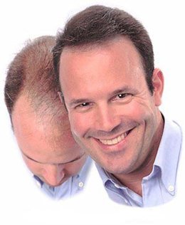 Tala Snake Oil Organic Hair Growth