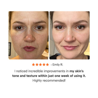Epify Glutathione Shot, Exfoliating Treatment for Face and Body, Deep Skin Re...