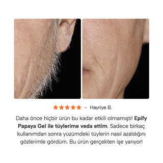 Epify Superfruit Papaya Gel Hair Removal Inhibitor, Post-Epilation Soothing Formula for Face and Body, 2.54 Fl Oz