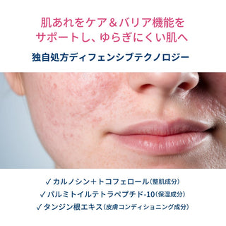 Bioderma Sensibio DS+ Cream - Soothing Moisturizing Cream for Sensitive Skin, Fragrance-Free, for Adults & Babies