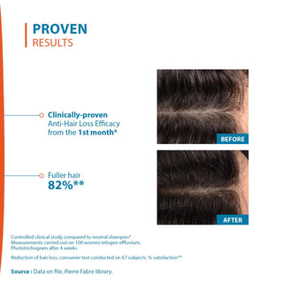 Ducray Creastim Reactiv Hair Loss Treatment Lotion - Stimulates Hair Growth, Restores Volume & Density