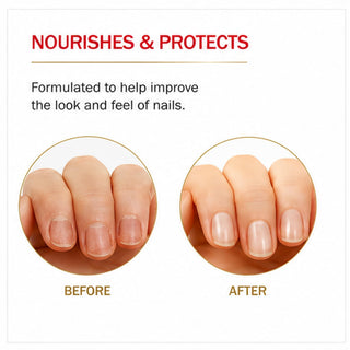 Mavala Mavaderma Massage Oil For Nails - Nourishing Nail Care Oil for Healthy Growth (10ml)