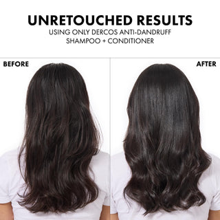 Vichy Dercos Anti-Hair Loss Shampoo with Aminexil - Strengthening, 6.76 fl oz