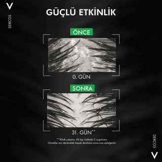 Vichy Dercos Anti-Dandruff Shampoo for Dry Hair - Salicylic Acid, Paraben-Free - Soothes Itching Scalp & Eliminates Flakes Vichy Dercos Anti-Dandruff Shampoo - Dry Hair & Itch Relief anti-dandruff shampoo, dandruff shampoo for dry hair, dry scalp shampoo, salicylic acid shampoo, paraben-free shampoo, itching scalp relief, dermatological shampoo, Vichy Dercos, kepek şampuanı, anti dandruff, dry hair, itchy scalp, flaky scalp, scalp treatment, dandruff control, moisturizing shampoo, hydrating shampoo, sensiti