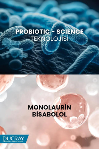 Ducray Kelual Squanorm Anti-Dandruff Shampoo: Relieve Itchy Scalp & Eliminate Flakes - For Normal to Oily Hair, Medicated Dandruff Treatment Ducray Anti-Dandruff Shampoo: Itch Relief & Flake Control anti-dandruff shampoo, dandruff shampoo for oily hair, itchy scalp shampoo, Ducray shampoo, Kelual Squanorm shampoo, shampoo for seborrheic dermatitis, dandruff treatment, medicated shampoo, anti dandruff, oily hair shampoo, itchy scalp relief, seborrheic dermatitis shampoo, medicated hair care, flake free, scal