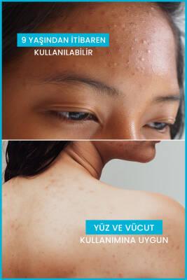 Ducray Keracnyl Foaming Gel 400ml - Acne Treatment Cleansing Gel for Oily Skin Ducray Keracnyl Foaming Gel 400ml - Acne Treatment acne treatment cleansing gel, Ducray Keracnyl Foaming Gel, oily skin care, acne prone skin cleansing, hypoallergenic skincare products, acne treatment, blackhead removal, gentle cleansing, salicylic acid, glycerin, zinc gluconate, paraben-free, soap-free, dermatologist-tested, skincare for sensitive skin