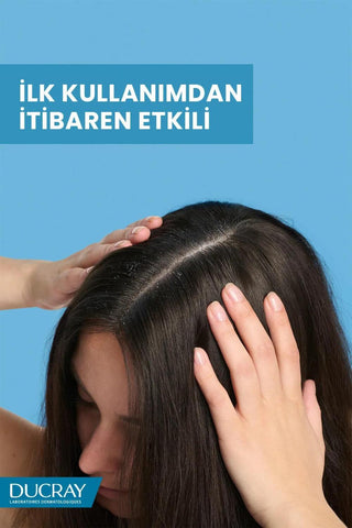 Ducray Kelual Squanorm Anti-Dandruff Shampoo: Relieve Itchy Scalp & Eliminate Flakes - For Normal to Oily Hair, Medicated Dandruff Treatment Ducray Anti-Dandruff Shampoo: Itch Relief & Flake Control anti-dandruff shampoo, dandruff shampoo for oily hair, itchy scalp shampoo, Ducray shampoo, Kelual Squanorm shampoo, shampoo for seborrheic dermatitis, dandruff treatment, medicated shampoo, anti dandruff, oily hair shampoo, itchy scalp relief, seborrheic dermatitis shampoo, medicated hair care, flake free, scal