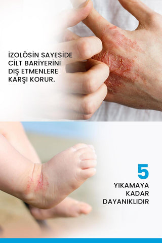 Ducray Dexyane: Barrier Cream for Dry, Atopic Skin - Strengthen, Soothe & Protect | Moisturizing Cream for Dermatitis Ducray Dexyane: Best Barrier Cream for Dry, Atopic Skin barrier cream, dry skin cream, atopic skin cream, skin barrier strengthening cream, Ducray Dexyane, soothing cream for dry skin, moisturizing cream for atopic dermatitis, dry skin, atopic skin, skin barrier, moisturizing, soothing, protecting, eczema, dermatitis, sensitive skin, skin irritation, redness relief, itching relief, skin care