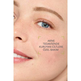 Bioderma Sebium Hydra: Soothing Face Cream for Acne-Prone Skin | Hypoallergenic Moisturizer for Redness Relief & Sensitive Skin Bioderma Sebium Hydra: Acne-prone Skin Soothing Moisturizer Bioderma Sebium Hydra, acne-prone skin moisturizer, soothing face cream, hypoallergenic moisturizer, non-comedogenic moisturizer, facial redness relief, sensitive skin moisturizer, oil-free moisturizer, Facial Moisturizer, hydrating face cream, Glycerin, Olive Oil, Allantoin, redness relief, anti-inflammatory, skin healing