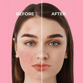 Sinoz Pink Touch SPF50+ Tone-Up Sunscreen: Color Correcting, Redness Reducing, and Brightening Mineral Facial Sunscreen with Hyaluronic Acid - 1.69 fl oz Sinoz Pink Touch SPF50 Sunscreen: Tone-Up & Color Correcting pink sunscreen, tone-up sunscreen, color correcting sunscreen, SPF50 sunscreen for face, sunscreen for redness, sunscreen for sensitive skin, brightening sunscreen, mineral sunscreen, facial sunscreen, sun protection, redness reduction, even skin tone, hyaluronic acid, niacinamide, bright oleoact