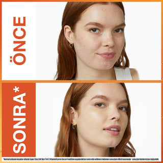 Maybelline Super Stay Skin Tint Foundation: Vitamin C for Radiant, Healthy Skin & Long-Lasting Complexion Perfection Maybelline Skin Tint: Vitamin C Foundation for Radiant Skin skin tint, foundation, vitamin C foundation, long lasting foundation, Maybelline foundation, radiant skin foundation, hydrating foundation, healthy skin foundation, skin tint makeup, complexion makeup, Maybelline, Super Stay, face makeup, vitamin C, radiant complexion, flawless coverage, long-lasting, makeup, beauty, cosmetics, moist