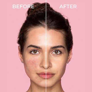 Sinoz Pure Cica Tiger Grass Facial Cream - Redness Relief, Tone Correction, Sensitive Skin Soothing, and Barrier Repair - Centella Asiatica Sinoz Cica Cream: Redness Relief & Skin Tone Correction Cica cream, Tiger grass cream, Redness relief cream, Skin tone correcting cream, Sensitive skin cream, Centella Asiatica cream, Soothing face cream, Anti-redness face cream, Facial redness treatment, Barrier repair cream, Facial Cream, Skin care, redness relief, skin tone correction, sensitive skin, Centella Asiati