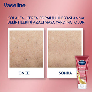 Vaseline Gluta-Hya Firming Body Lotion: Hyaluronic Acid & Collagen for Radiant, Firmer Skin - Intense Hydration, Anti-Aging, Non-Greasy Formula Vaseline Gluta-Hya Lotion: Firm, Radiant Skin - Hydration body lotion, glutathione lotion, hyaluronic acid lotion, anti-aging body lotion, skin firming lotion, moisturizing body lotion, dry skin lotion, collagen body lotion, radiant skin lotion, non-greasy body lotion, GlutaGlow Technology, Hyaluronic Acid, Collagen, water-based formula, 5-day firmness, skin hydrati