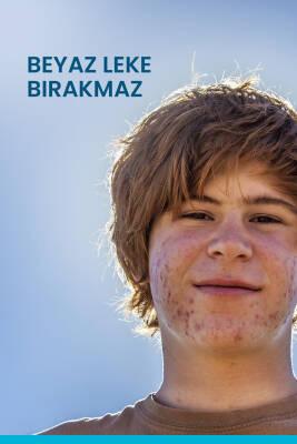 Ducray Keracnyl UV SPF50+ Anti-Blemish Sunscreen Fluid for Acne-Prone Skin - Matte Finish, Non-Comedogenic Ducray Keracnyl UV SPF50+ Anti-Blemish Sunscreen Fluid anti-blemish sunscreen, SPF50+ sun protection, non-comedogenic skincare, acne-prone skin care, matte finish sunscreen, Ducray Keracnyl, oily skin solutions, blemish reduction, sun protection for face, daily sunscreen, skincare for acne, non-comedogenic products