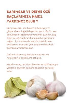 Hunca Care: Garlic & Bay Laurel Hair Strengthening Shampoo - Anti-Hair Loss, Natural Botanical Extracts for Thicker, Healthier Hair - 22.82 fl oz Hunca Care Garlic Shampoo: Stop Hair Loss & Grow Thicker Hair Hair strengthening shampoo, Anti-hair loss shampoo, Garlic shampoo, Bay laurel shampoo, Natural shampoo for hair growth, Shampoo for thinning hair, Hunca Care shampoo, Shampoo with botanical extracts, hair loss, hair thinning, natural hair care, hair growth, healthy hair, botanical extracts, gentle sham